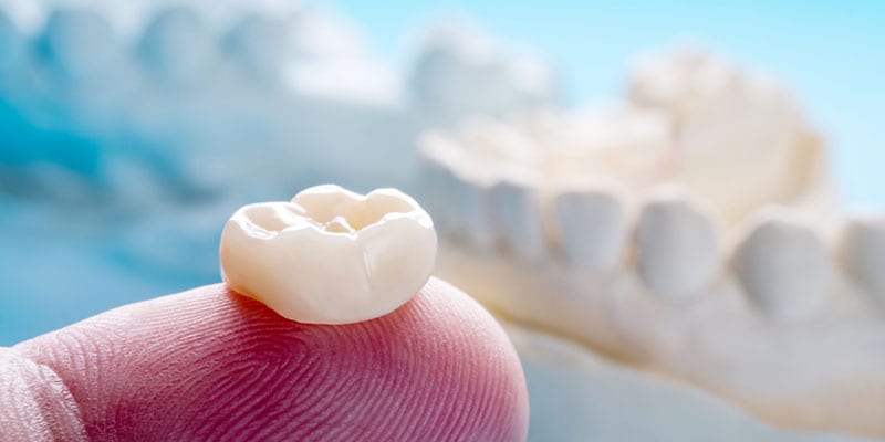 Need Dental Crowns? We Make it Convenient!