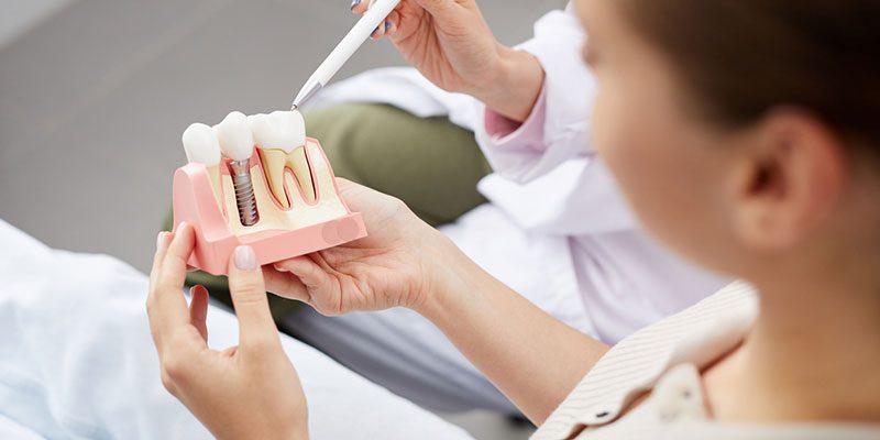 Are Dental Implants Right for You?