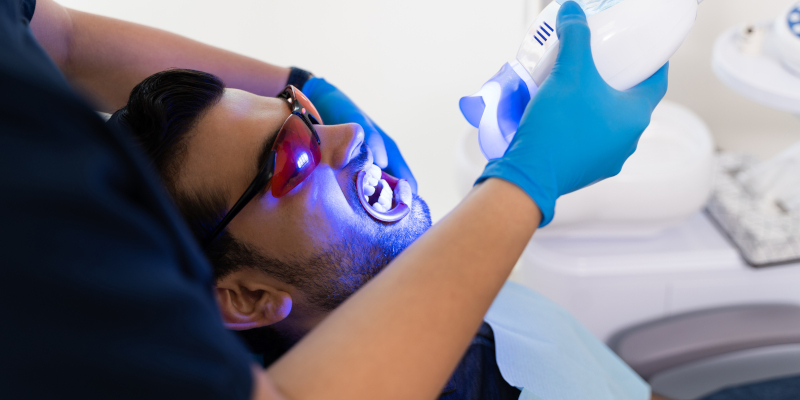 Why You Should Avoid DIY Teeth Whitening